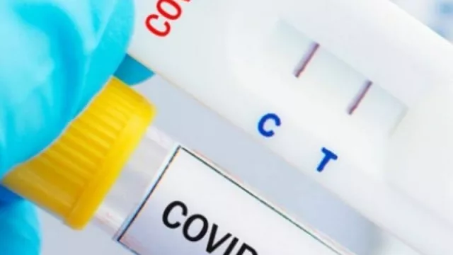 Los hisopados, la estrella de esta temporada (cuánto cuesta hacerse un PCR en Punta del Este)