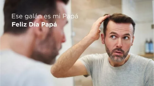 Lo último en tratamiento de recuperación capilar para el “galán” de Papá 