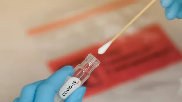 Ancap y Española se unen para colaborar (hisopados gratuitos por 72 horas)