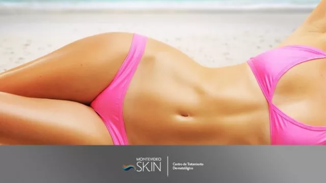 37 días para el verano y llegan las recomendados de Montevideo Skin