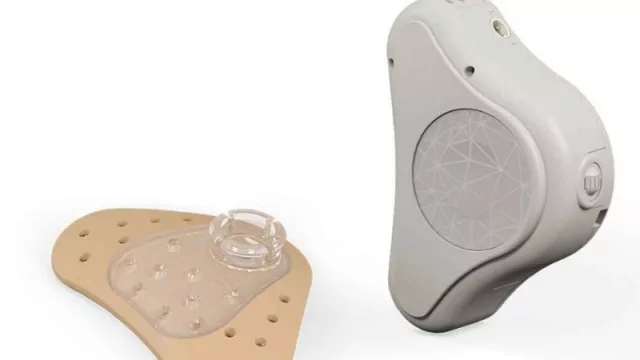 ¿AHORA ME ESCUCHÁS? se lanza nueva tecnología para pacientes con sordera