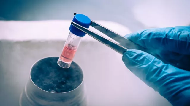 La medicina regenerativa ya es una realidad: se aprobó el primer tratamiento para diabetes tipo 1 con células madre (y los bancos locales se preparan)