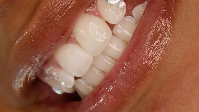 Tu sonrisa es una joya (Giorgina De Castris y el arte de personalizarla con cristales Swarovski)